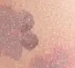 MELBA BLUSH